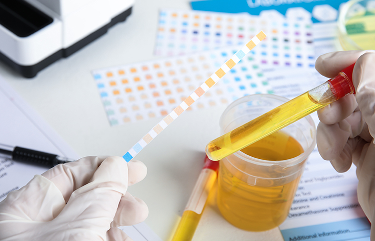 Urine Test in Ludhiana